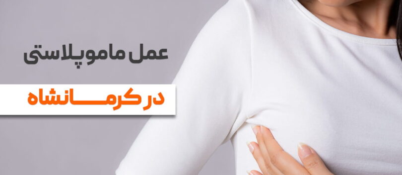 جراح زیبایی سینه کرمانشاه,جراحی زیبایی سینه در کرمانشاه,دکتر ماموپلاستی در کرمانشاه